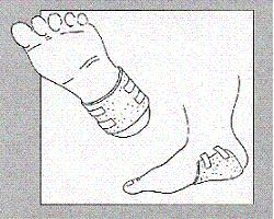 Medicazione assorbente in poliuretano espanso ligasano struttura a nido d'ape non sterile 24x16cm altezza 1cm 10 pezzi